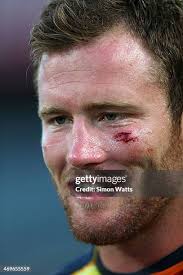 73 Gavin Eden Photos & High Res Pictures