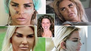 19.10.2021 · the cost of animal feeds has subsequently gone up across all the meal types, which are now retailing at an average of sh100 more than the previous cost. Katie Price S Plastic Surgery Transformation Over The Last 25 Years After Finding Fame Aged 17 Mirror Online