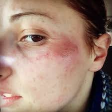 Rachel Ranson (@RachelRansprobs)