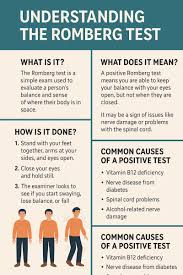 Image result for Romberg Test