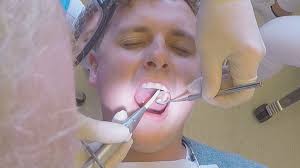 Sukker er gift for dine tænder: Her er tandlægens gode råd