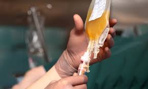 Image result for Plasma Transfusion
