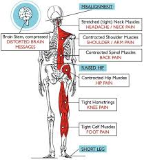 Why Chiropractic Atlas Chiropractic Nutrition