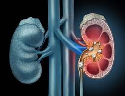 Dermatologice caini afectiuni cardio afectiuni digestive afectiuni hepatice afectiuni renale / urinare afectiuni sistem nervos antibiotice orale antiinflamatoare antiparazitare interne si externe articulatii diverse caini orl caini suplimente nutritive, vitamine vitamine si suplimente. Durere De Rinichi Ce Simptome O Insotesc Cauze Tratament Preventie Sensiblu Com