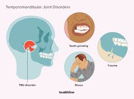 Image result for Jaw Dislocation
