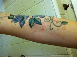 Staph Tattoo Infections Tattoo Design