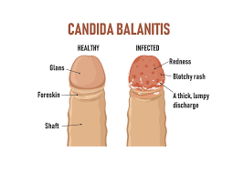 Penis swelling after masturbating