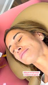 💋 Thinking about lip filler? Here’s what to expect after your treatment:,  ✨ A little swelling and tenderness for the first couple of days (totally  normal!), ✨ Minor bruising may happen but fades ...