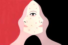 Get prescription drug refills right over the phone.1. How To Get Rid Of Acne 25 Skin Care Tips From Dermatologists Teen Vogue