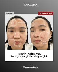 Rekomendasi layering serum yang wajib di save!👌🏻 Banyak banget nih yang  nanya ke Lora, 𝗦𝗮𝗹𝗺𝗼𝗻 𝗗𝗡𝗔 𝗦𝗲𝗿𝘂𝗺 & 𝗕𝗶𝗿𝗱𝗻𝗲𝘀𝘁 𝗦𝗲𝗿𝘂𝗺  bisa dilayering sama serum lain nggak?🧐 No worries, Implovers! Tentu bisa  dong😍