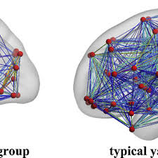 Lei lan*, yang yin*, danny kaufman, junfeng yao, minchen li, chenfanfu jiang, medial ipc: Pdf Mechanism Differences Between Typical Yin And Typical Yang Personality Individuals Assessed By Five Pattern Personality Inventory Fppi Evidence From Resting State Brain Functional Networks