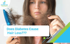 Can Diabetes Cause Hair Loss? Understanding the Connection