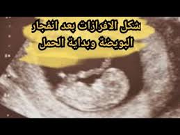 شكل الافرازات بعد تلقيح البويضة وبداية الحمل هل تستمر الافرازات بعد التبويض Youtube