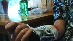 Check spelling or type a new query. Iowa Teen Burned Doing Salt And Ice Challenge Wics