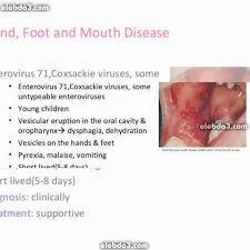 1 it involves the ongoing systematic collection, collation, analysis and interpretation of data on disease occurrence and public health related events and dissemination of the information obtained from such data for prompt. Ù…Ù‚Ø§Ù„ Ø§Ù„ÙˆØ±Ø¯ÙŠØ© Ø§Ù„Ø·ÙÙ„ÙŠØ© Ø§Ù„Ø§Ù…Ø±Ø§Ø¶ Ø§Ù„Ø§Ù†ØªØ§Ù†ÙŠØ© Ø§Ù„ÙÙŠØ±ÙˆØ³ÙŠØ© Ø¹Ù†Ø¯ Ø§Ù„Ø§Ø·ÙØ§Ù„