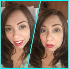 Can we talk about the makeup? Wasn't Noah in the hospital bed with no  bandage