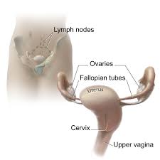 The ovaries are the parts of the female reproductive system that produce a woman's eggs and female hormones. Lymph Node Surgery For Advanced Ovarian Cancer National Cancer Institute