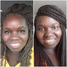 Overcoming health scare through faith and persistence