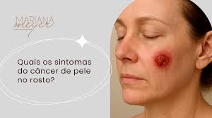 Câncer de pele no rosto: como identificar?