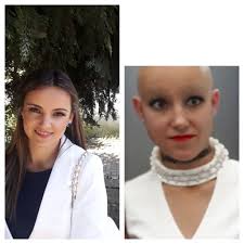 What is the impact of using bald models in fashion photography?