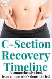 After Experiencing Two C Sections I Decided It Was Finally Time To Write Down A C Section Recovery Tim C Section Recovery Timeline C Section Recovery C Section