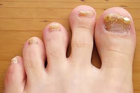 an overview of common toenail problems