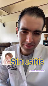 Sinusite Aguda