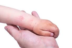 Ada berbagai merek baby cream yang seringkali membuat anda bingung sebelum anda memilih krim bayi, bahan dasar yang digunakan merupakan hal penting yang harus anda ketahui. Mupirocin Manfaat Dosis Dan Efek Samping Alodokter