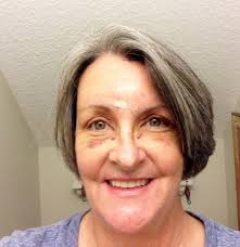 Did Not Have Side or Top Vision, It Was Like Tunnel Vision