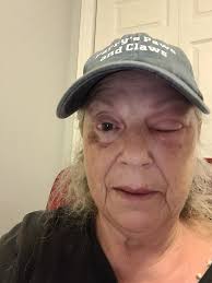 Vendor absent from market due to illness