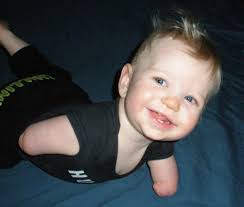 The Need For His Hands