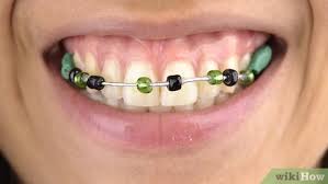 Maybe you would like to learn more about one of these? How To Make Fake Braces 11 Steps With Pictures Wikihow