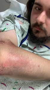 Look goofy but helmets are safer makk TTEKIAR 2эЕ PAC PACTORYENN M shat ตา  to moteE sharcnmategrnydursu-2024 350 stydu 2024 起け .... ሰኬ