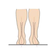 Also er sitzt am hintern, knie angewinkelt und die fersen sind neben den hüften. Kinderfusse Kinderfusscheck