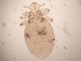 Image result for what do Mallophaga look like in dog fur