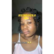 “I just woke up like this!” — Lady seeks urgent advice after mysteriously  waking up with swollen lips, 📹: @girlfriend_207, #Instablog9jaVibes  #HealthAlert #WetinCauseAm #SwollenLipsMystery ...