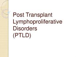 Ppt Post Transplant Lymphoproliferative Disorders Ptld Powerpoint Presentation Id 1078387