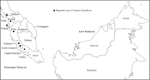 This includes promoting businesses through google maps links. Map Of Malaysia Showing States With Reported Case Of Human Brucellosis Download Scientific Diagram