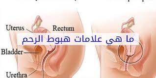 أهم 10 أعراض لنزول الرحم