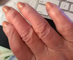 Folic acid, or vitamin b9, helps prevent damage to your nerve cells and keeps red blood cells healthy. Is It Possible To Grow Your Fingers Longer What Exercises Can I Do I Am 29 So I Am Well Past A Growing Age Height Wise Quora