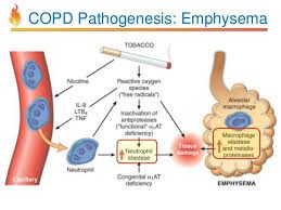 image result for copd pathophysiology respiratory system