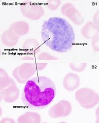 Image result for Monocyte Count