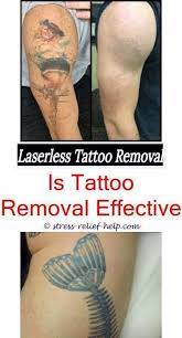 Tattoo Removal Near Me Does Laser Completely Remove Tattoo Laser Tattoo Remova Comple Tattooentfernung Diy Tattoo Weisse Tatowierungen