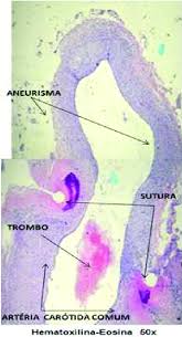 The word is from greek: Caracteristica Da Lamina Histologica Do Aneurisma Download Scientific Diagram