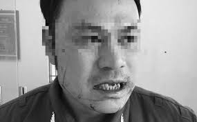 Cấm bay 1 năm hành khách hành hung nhân viên an ninh sân bay