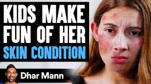 Kids MAKE FUN Of Girl's SKIN CONDITION, What Happens Is Shocking