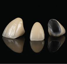 Welcome to the peoplenet fleet manager. Pfm Crown Pfm Bridge Zirconia Pfm Dental Crown Dubai