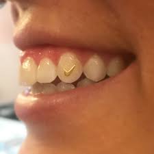 Nike Swoosh We Love Doing Tooth Gems Tooth Gem Teeth Jewelry Diamond Teeth