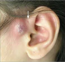 Pin Di Obat Herbal