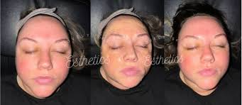 Lovely Skin Esthetics